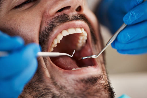Best Wisdom Tooth Removal  in Eagle Lake, WI
